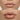 Normal Lip Plumper - Lipz