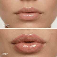 Normal Lip Plumper - Lipz
